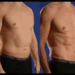 عضلات البطن : طريقة بسيطة للحصول على بطن مشدودة في فترة وجيزة