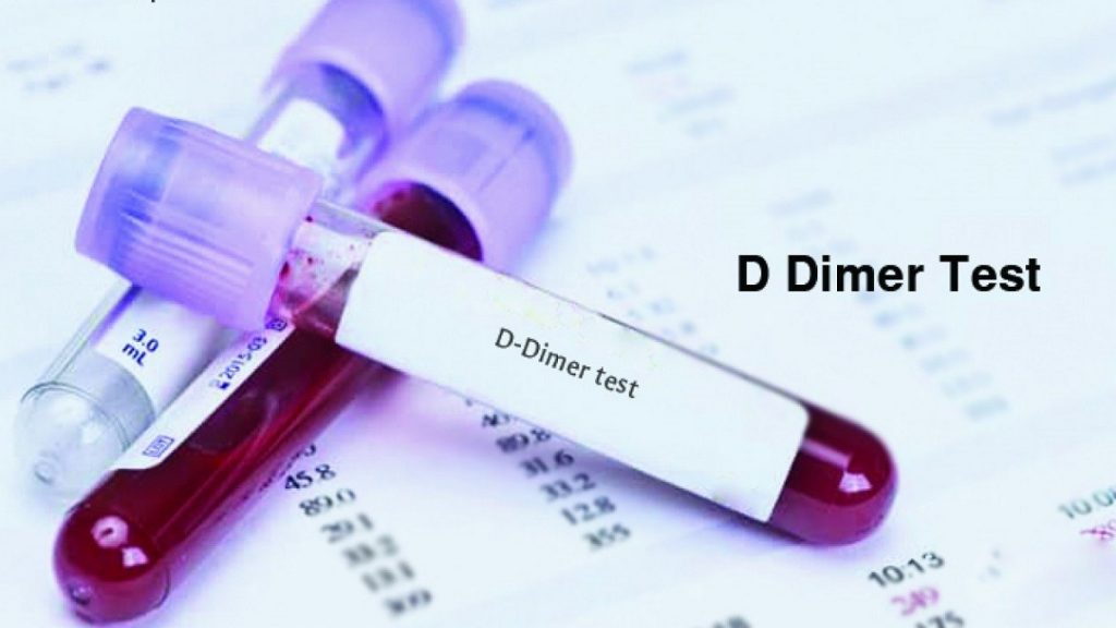 تحليل D-dimer