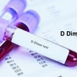 تعرف على تحليل D- dimer وأهميته