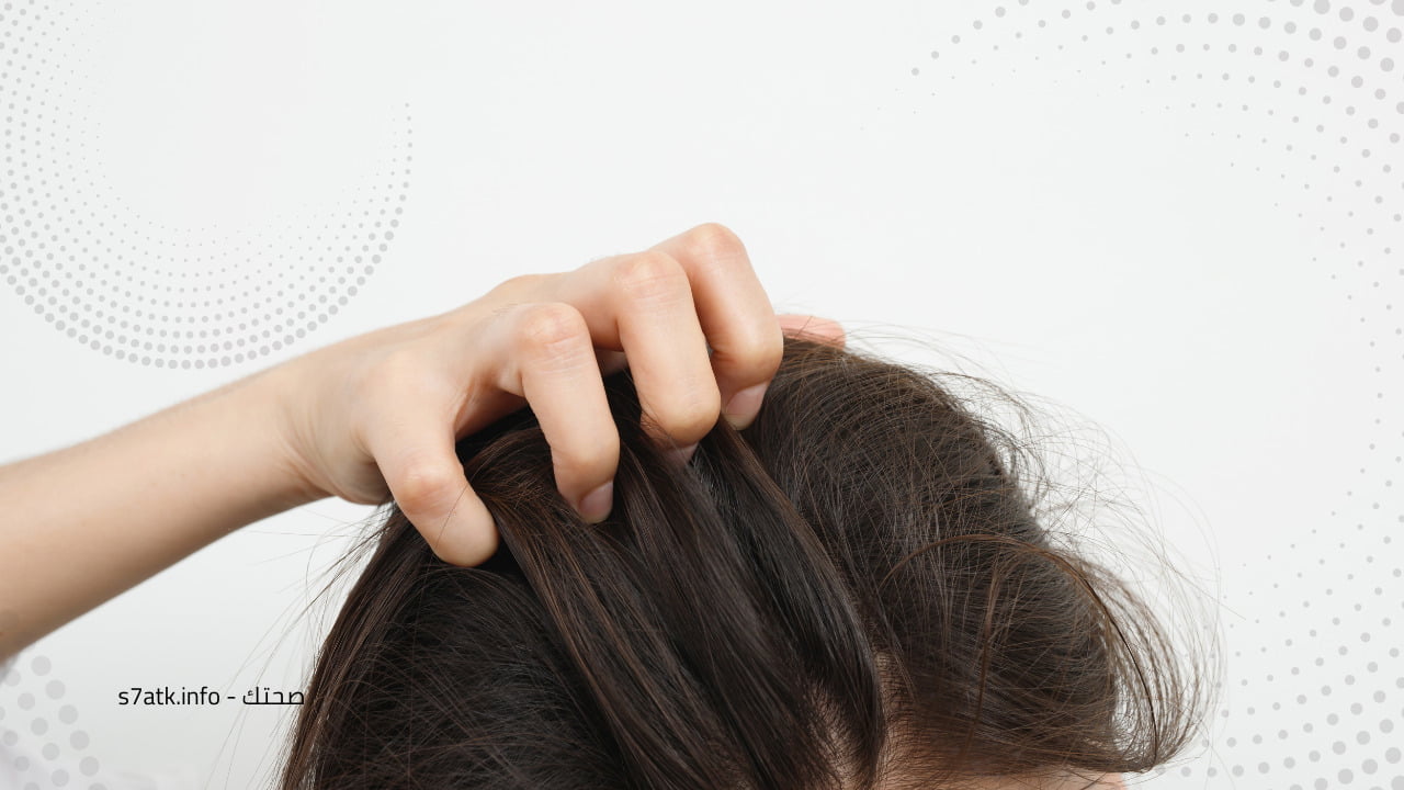 هل يمكن علاج قشرة الشعر بالأعشاب؟