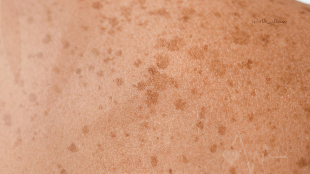 العوامل التي تؤثر سلبًا على مظهر الجلد والبشرة
