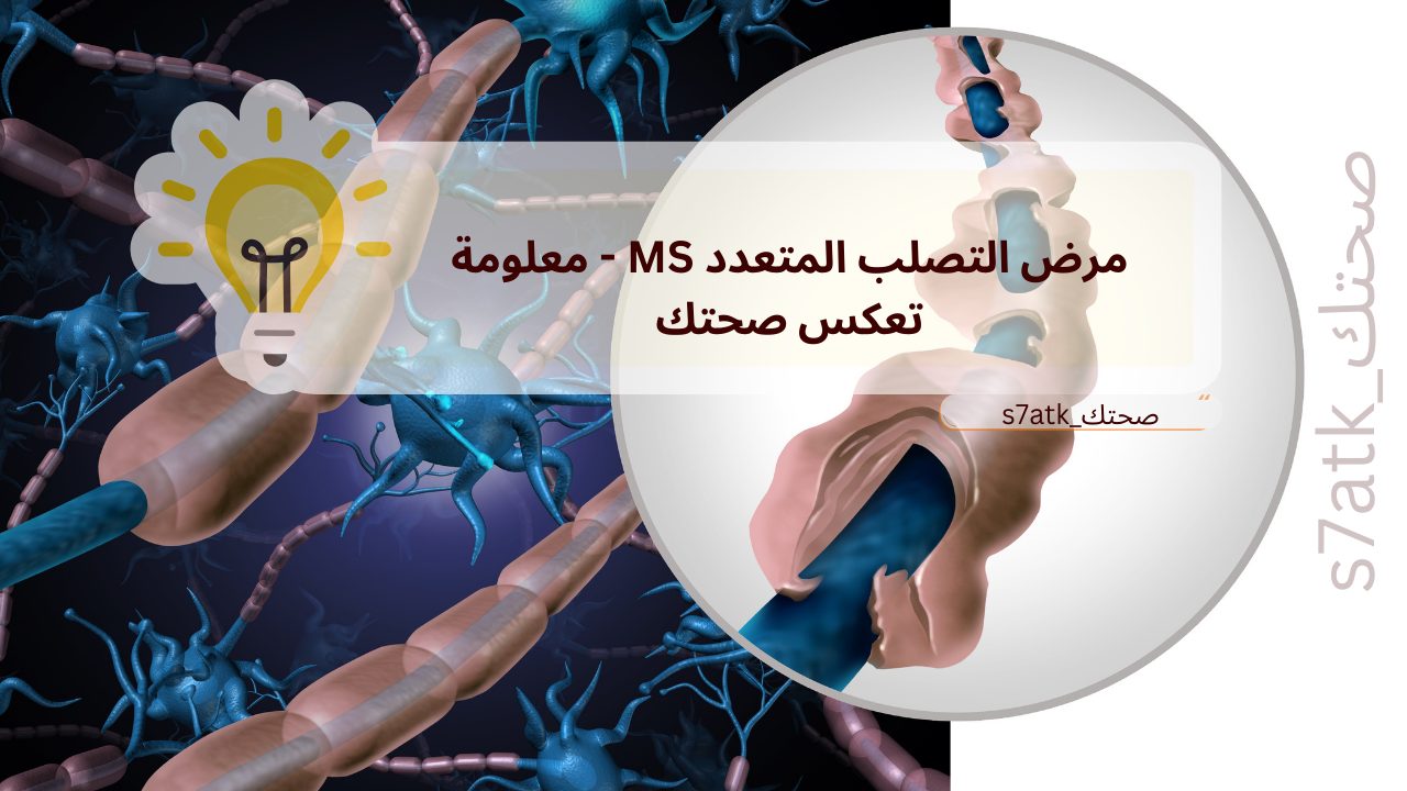 مرض التصلب المتعدد MS - معلومة تعكس صحتك